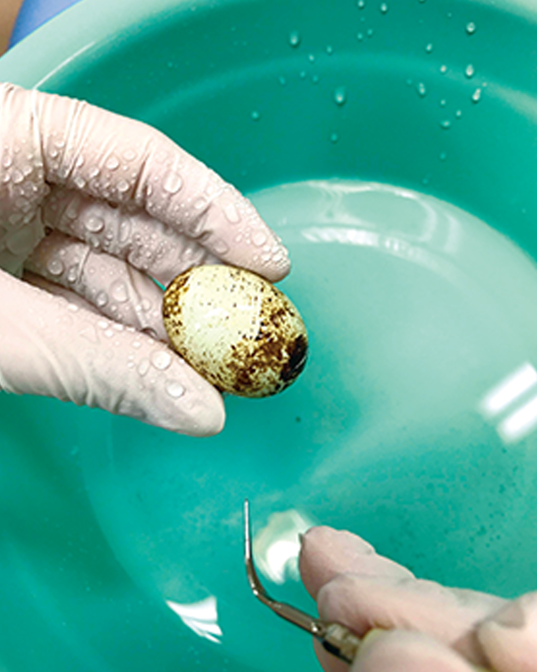 「超音波スケーラー」という歯科用機器を使ってみよう！